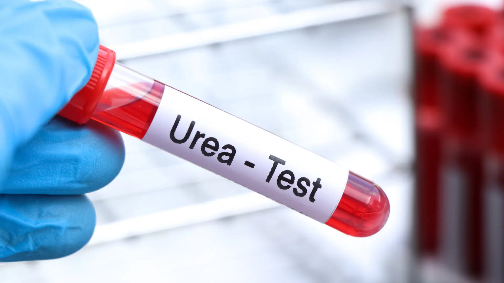 Blood Urea Nitrogen